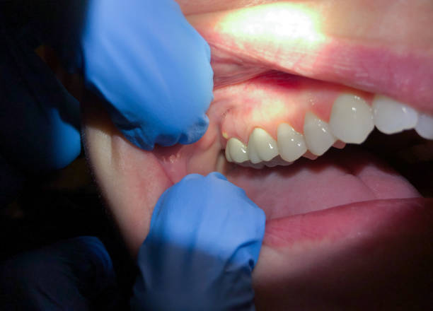 Best Broken or Chipped Tooth Repair in Dakota Dunes, SD