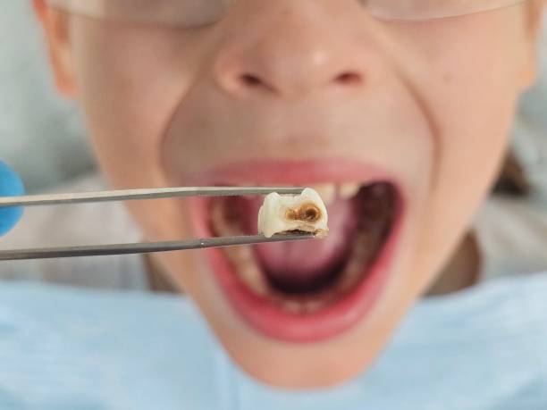 Best Emergency Care for Gum Disease in Dakota Dunes, SD